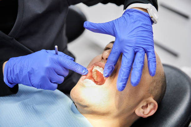 Best Emergency Wisdom Teeth Removal in Narrows, VA